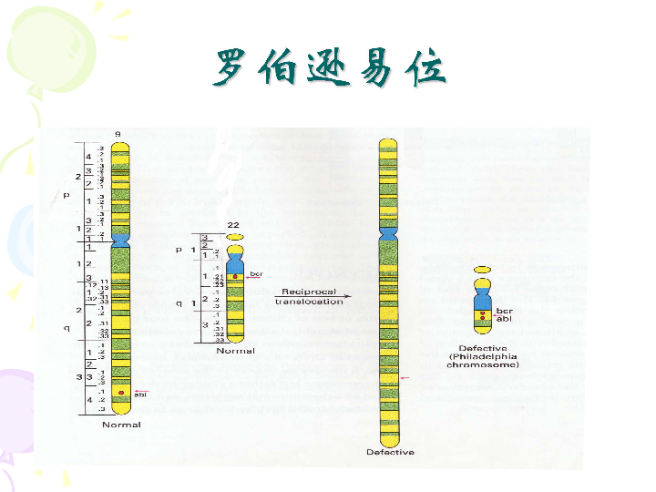 罗伯逊易位图片